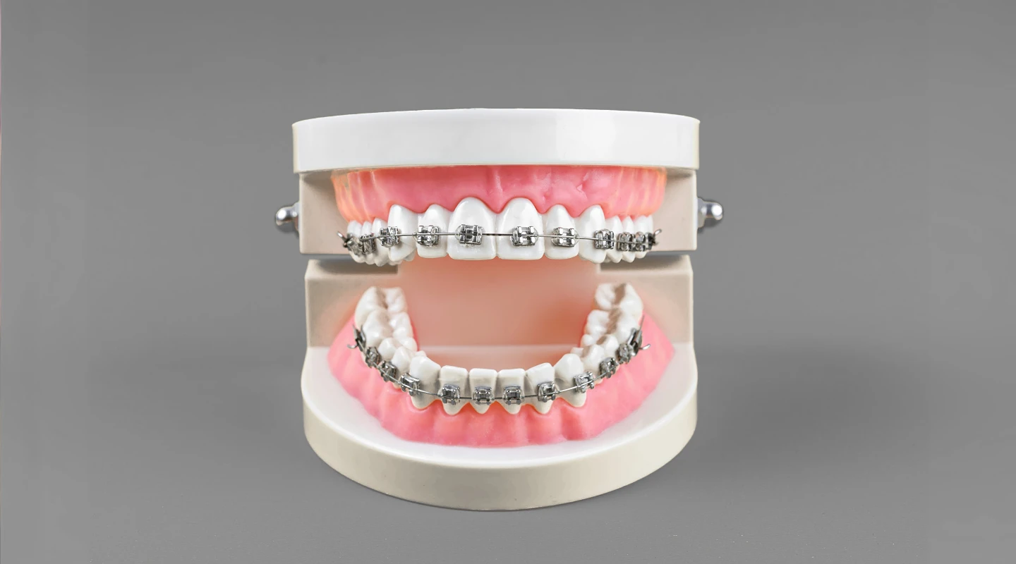 sure smile technology