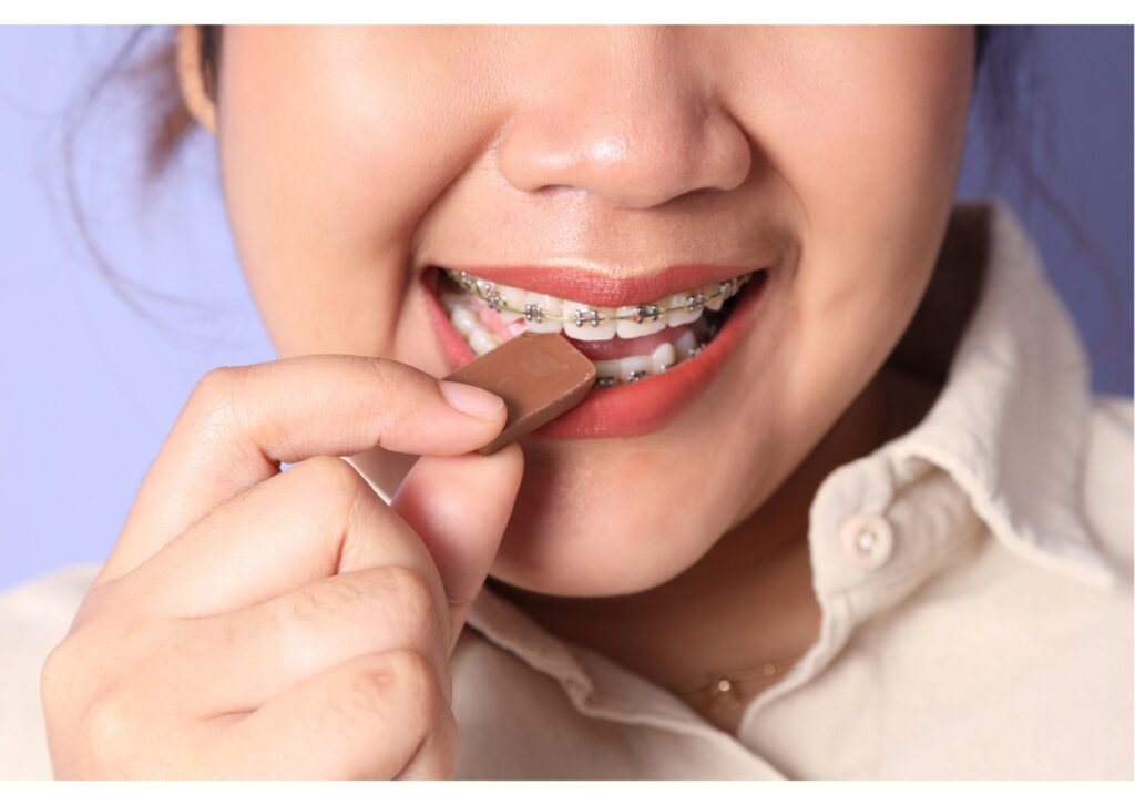 Person with braces eating chocolate candy, showing proper bite and brackets.